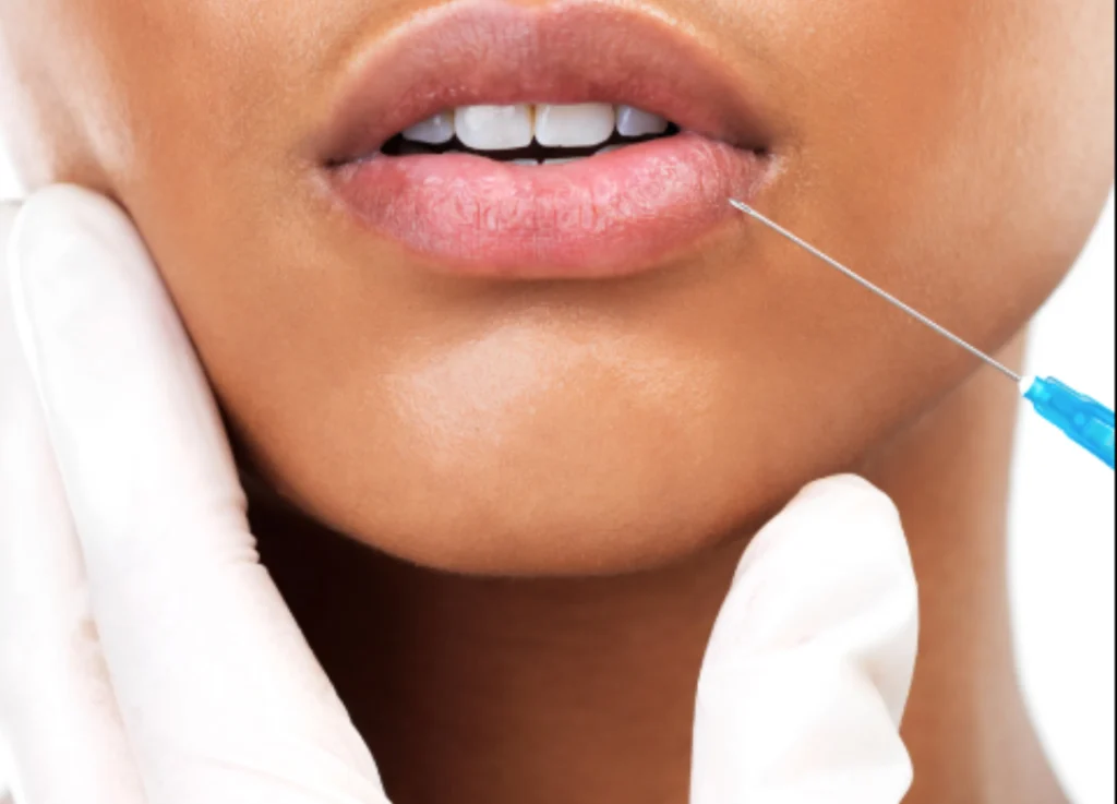Feel radiant and confident with our lip filler treatments.