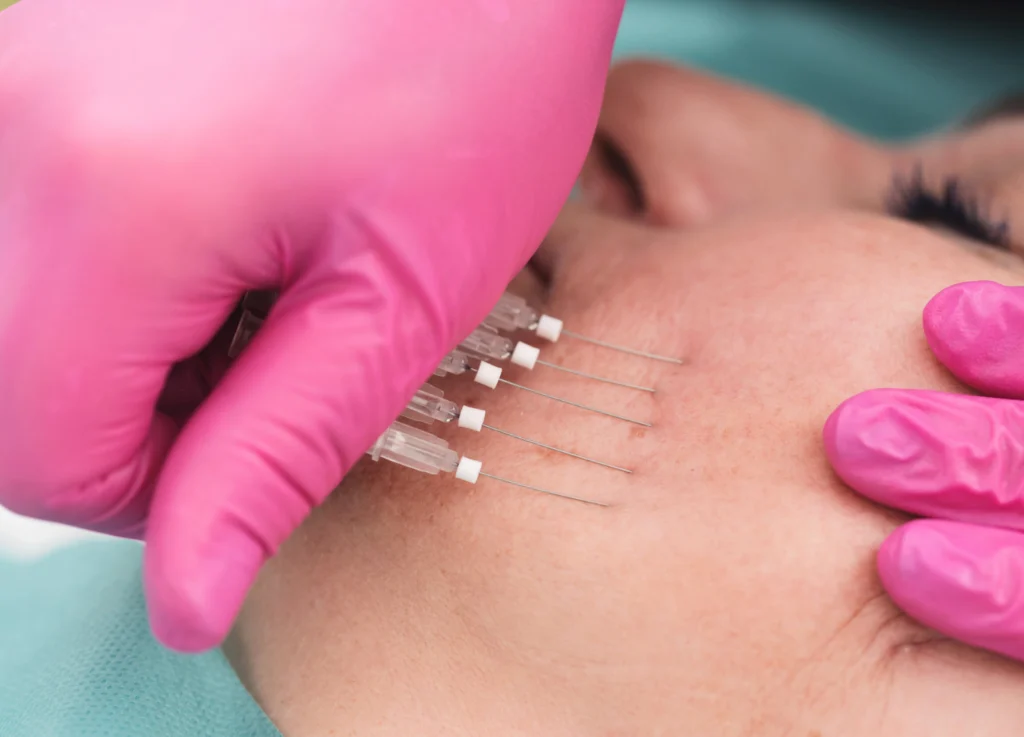 Medical Professional Performing Facial Injection Procedure