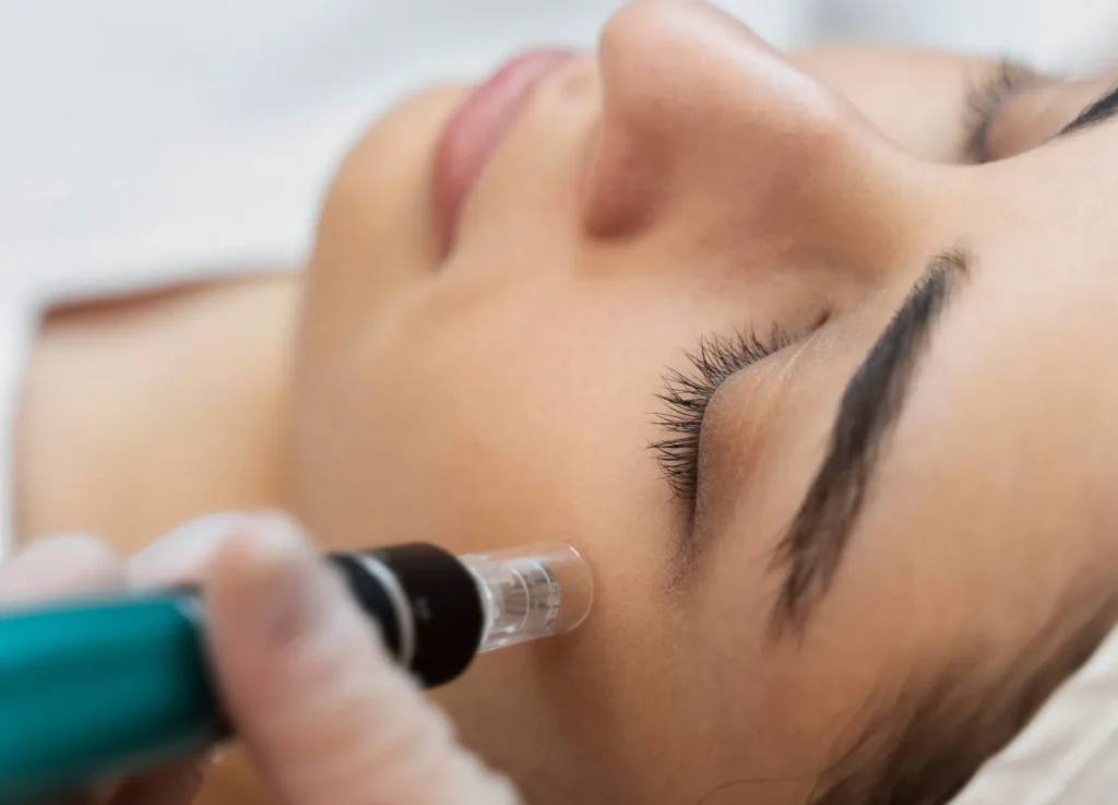 Forehead Injection Procedure by Skilled Specialist