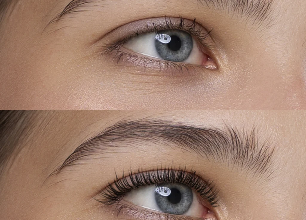 Say goodbye to dark circles and puffiness.